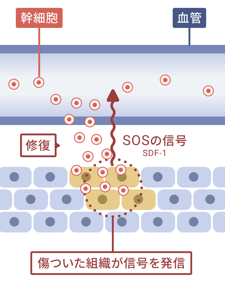 傷ついた細胞組織からSOS信号のSDF-1が放出され、それに引き寄せられた幹細胞が組織の修復を促します。